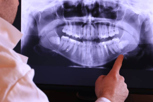 Best Emergency Denture Repair in Lake Como, NJ